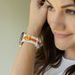 Can You 🐝🍂 It’s Fall White & Orange Skye Watchband